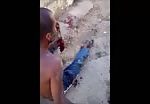 Man's hand barely hanging on after machete attack 1
