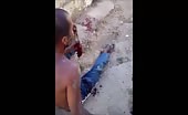 Man's hand barely hanging on after machete attack 24