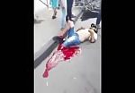 Guy gets his leg chopped off in bike accident 1