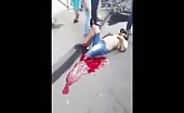 Guy gets his leg chopped off in bike accident 15