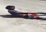 Horrible bike accident in jamaica one leg chopped 2