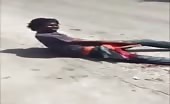 Horrible bike accident in jamaica one leg chopped 16