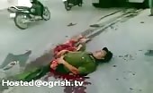 Man ripped half but still alive in china 11