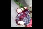 Brazilian young guy shot and bleeding 2