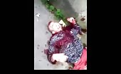 Brazilian young guy shot and bleeding 4
