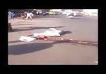 Cell phone video of man with popped brain in accident 2
