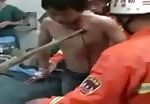 Chinese man impaled with a stick 1
