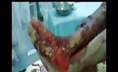 Machete wounds and chopped hands 5