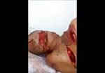 Man slashed and hacked by machete 2