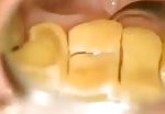 Nasty yellow teeths 2
