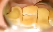 Nasty yellow teeths 7