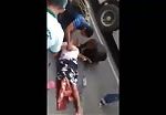 Woman leg crushed in accident 1