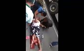 Woman leg crushed in accident 4