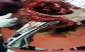 Lady impaled with big metal scrap through her head 8
