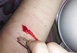 Sick girl cutting her arm with a razor 1