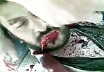 Iraqi guy shot and breathing last moments 2
