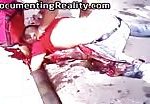 Leg and arm mangled up laying dead in the gutter 2