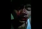 Man self mutilates himself after breakup with girlfriend 2