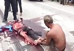 Victim of accident in cambodia 2