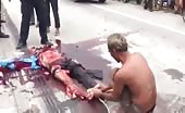 Victim of accident in cambodia 6