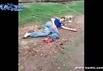 Drunk man attempting loses his foot to a passing train 2