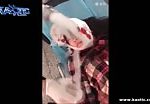 Girls scalp is ripped off her skull 1