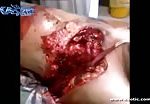 Mans beating heart is exposed in his torn open chest 3