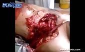 Mans beating heart is exposed in his torn open chest 14