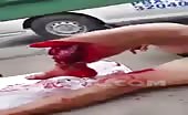 Man`s leg is messed up badly 16