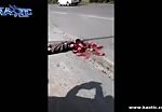 Guy turned into a mess after being run over by a truck 2