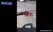 Guy turned into a mess after being run over by a truck 15