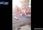 Legs sliced off in motorcycle accident 1
