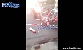 Legs sliced off in motorcycle accident 5