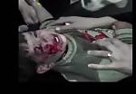 Children wounded by assad gang (graphic content) 1