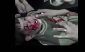 Children wounded by assad gang (graphic content) 15
