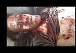 Dismembered and extremely wounded! 2