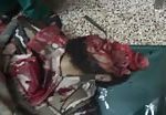 Killed in indiscriminate shelling 1