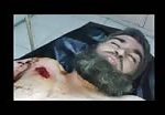 Man brutally injured with deep wounds 2