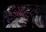 One of the victims of brutality of syrian forces 2