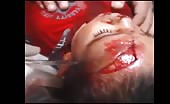 Child with nasty head injury 14