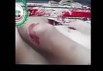 Man brutally tortured and shot in the ribs 1