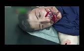 Syrian boy with nasty mouth injuries 3