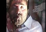 Victim of bombing on syrian city 3