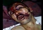Victims of brutality of syrian army 3