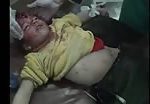Child dead hit by shrapnel (graphic content) 2