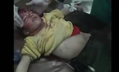 Child dead hit by shrapnel (graphic content) 4