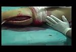 Conducting a biopsy on severed leg 1