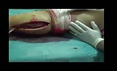 Conducting a biopsy on severed leg 6