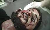 Dead man with fatal wounds 1