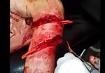 Ghastly ripped cut in arm 2